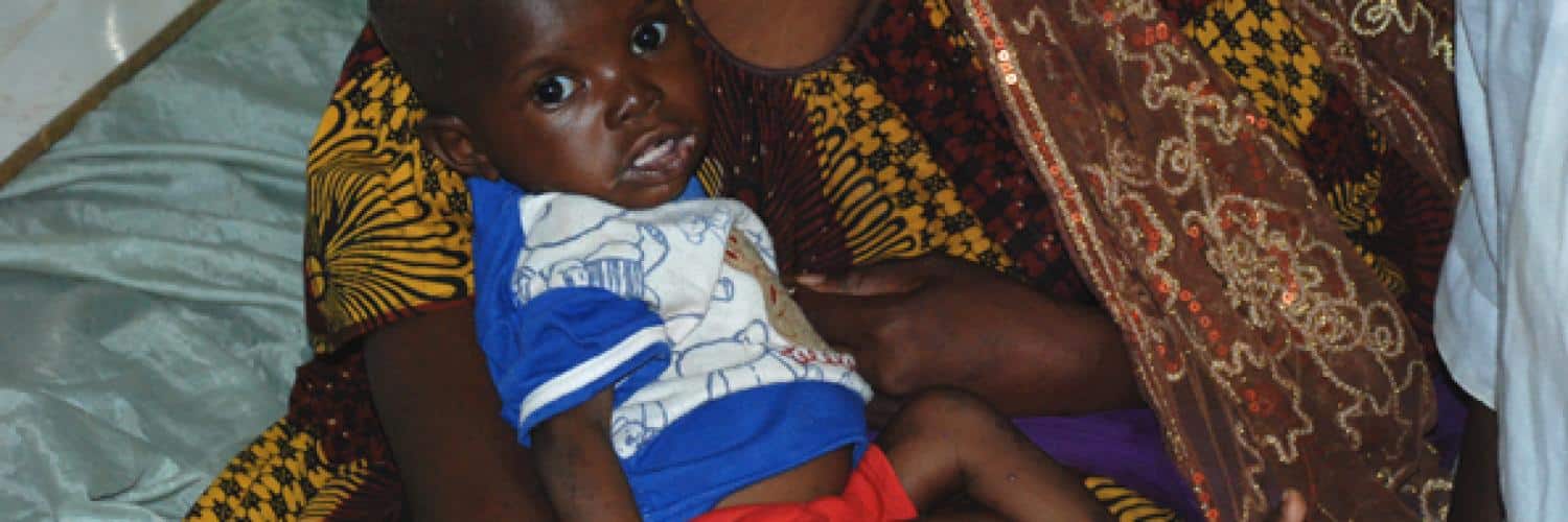 Malnutrition au Mali : enjeux et solutions pour un avenir sain