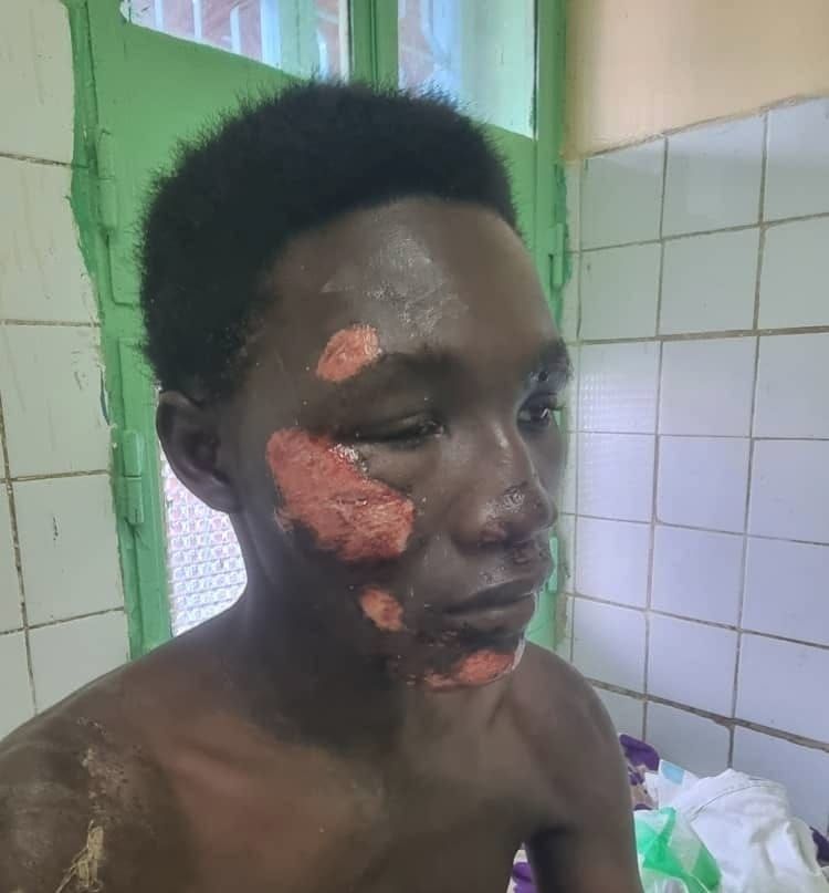 Tchad : agression près du camp 27 à N’Djaména, un père exige des mesures de sécurité renforcées